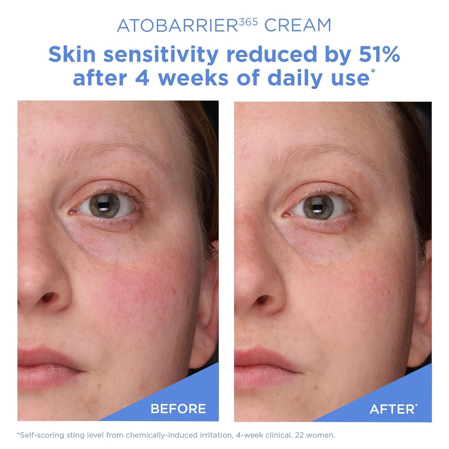 ATOBARRIER365 Cream with Ceramides, Korean Moisturizer for Skin Barrier Repair | Long-Lasting Hydration, Ceramide Capsules, Dry & Sensitive Skin, Non-Comedogenic, 80 Ml / 2.70 Fl.Oz.