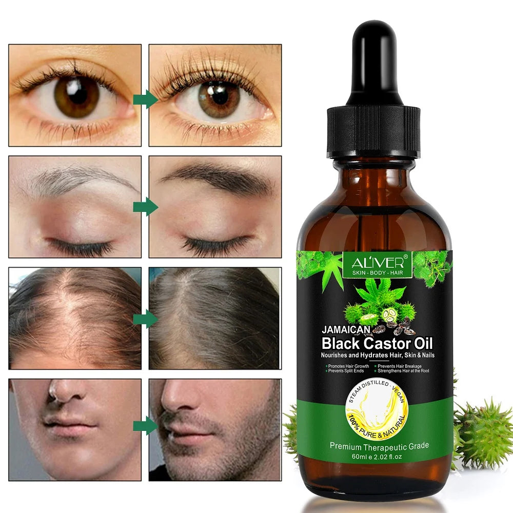 Jamaican Black Castor Oil for Hair Growth & Skin Conditioning - Nourishes and Hydrates Hair, Skin & Nails - 100% Pure Cold Pressed - 2 Oz
