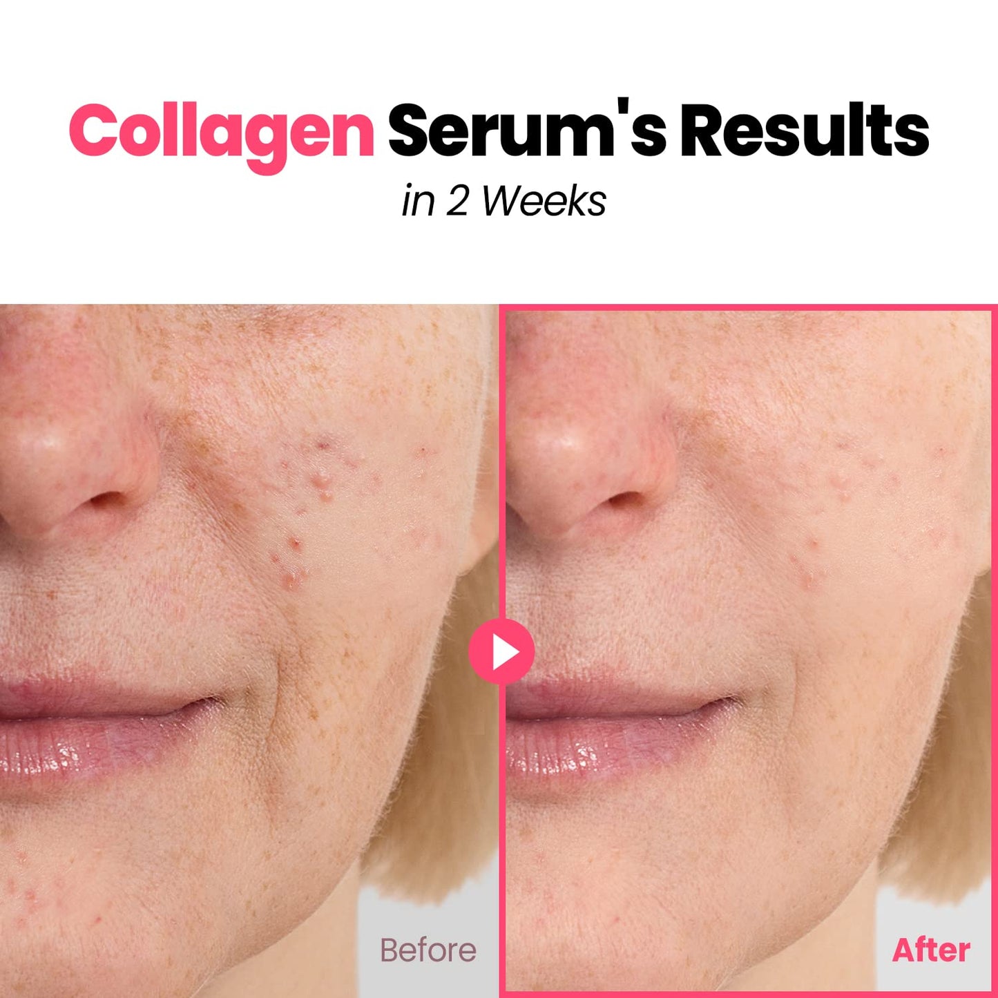 Plump Nourishing Dive in Real Marine Collagen Serum - anti Aging with Hyaluronic Acid, Lifting,Tightening Skincare, Repair Skin with Peptide Complex Facial Serum 30Ml (1.01 Fl Oz)