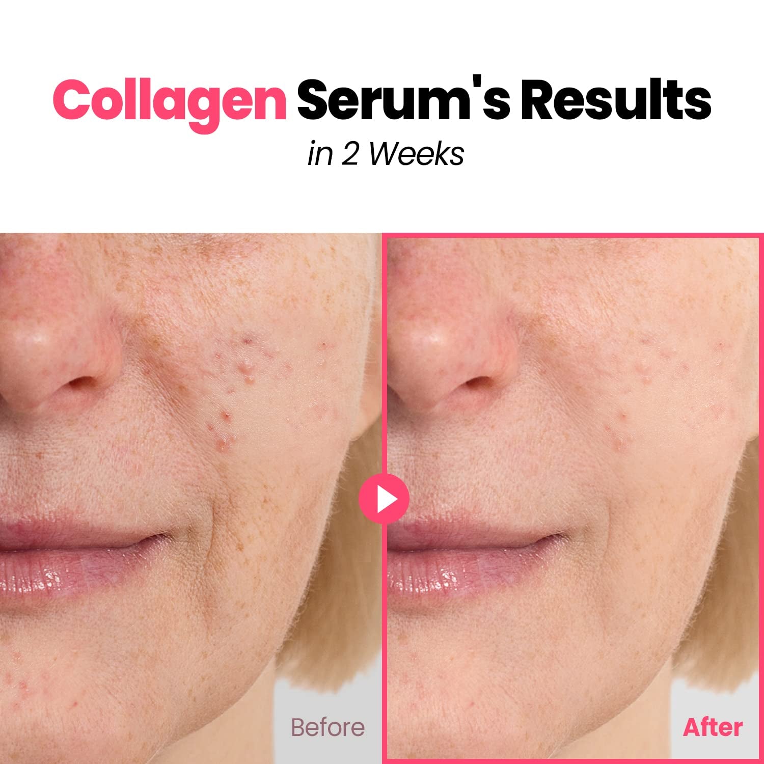 Plump Nourishing Dive in Real Marine Collagen Serum - anti Aging with Hyaluronic Acid, Lifting,Tightening Skincare, Repair Skin with Peptide Complex Facial Serum 30Ml (1.01 Fl Oz)